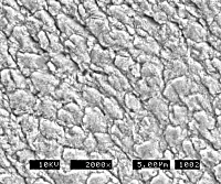 37% phosphoric acid etching