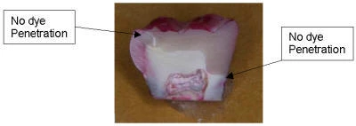 Class II dye penetration